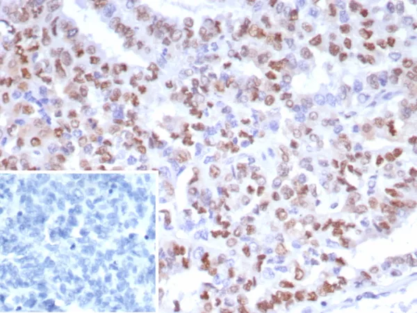 Recombinant PMS2 (Postmeiotic Segregation Increased 2) Antibody