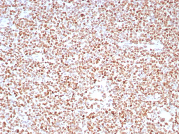 Recombinant PMS2 (Postmeiotic Segregation Increased 2) Antibody - Image 2