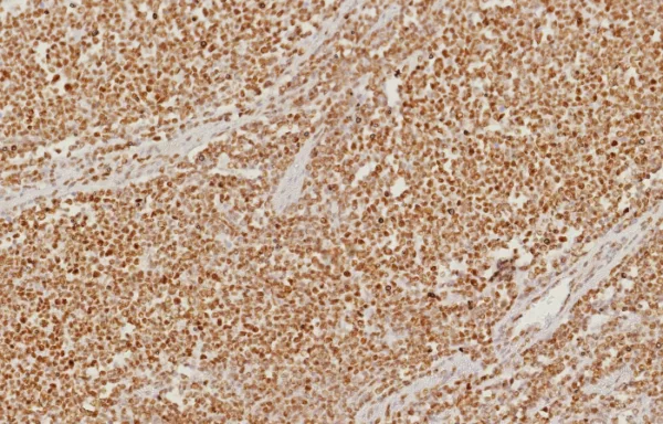 Recombinant PMS2 (Postmeiotic Segregation Increased 2) Antibody - Image 2