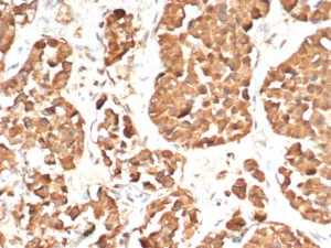 Formalin-fixed, paraffin-embedded human pituitary gland stained with ACTH Recombinant Rabbit Monoclonal Antibody (CLIP/7197R). HIER: Tris/EDTA, pH9.0, 45min. 2°C: HRP-polymer, 30min. DAB, 5min.