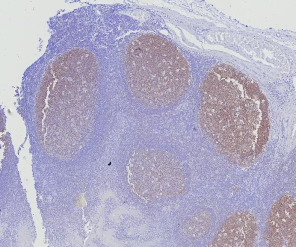 Formalin-fixed, paraffin-embedded human tonsil stained with BOB1 Mouse Monoclonal Antibody (BOB1/7469). HIER: Tris/EDTA, pH9.0, 45min. 2°C: HRP-polymer, 30min. DAB, 5min.