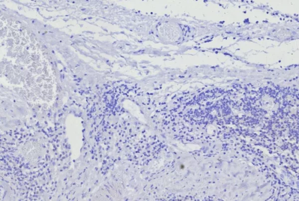 IHC analysis of formalin-fixed, paraffin-embedded human skin in tonsil. Negative tissue control using BOB1/7469 at 2ug/ml in PBS for 30min RT.  HIER: Tris/EDTA, pH9.0, 45min. 2°C: HRP-polymer, 30min. DAB, 5min.