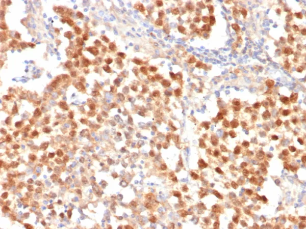 Recombinant OCT-4 (POU5F1) (Germ Cell Tumor Marker) Antibody