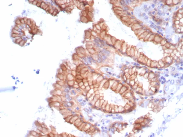 Formalin-fixed, paraffin-embedded human stomach stained with Migfilin-1 Recombinant Rabbit Monoclonal Antibody (FBLIM1/8189R). HIER: Tris/EDTA, pH9.0, 45min. 2: HRP-polymer, 30min. DAB, 5min.