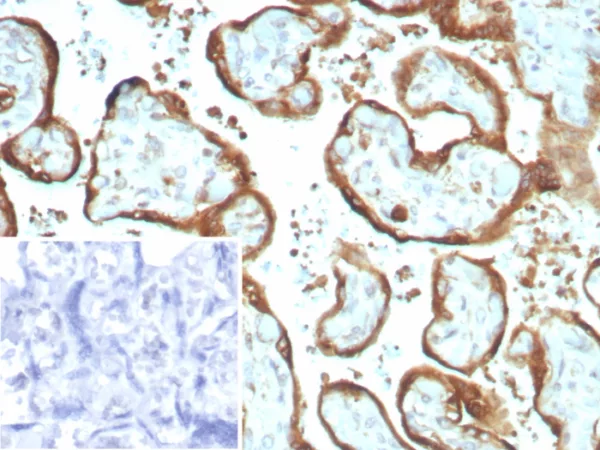 Recombinant IMP-3 Antibody