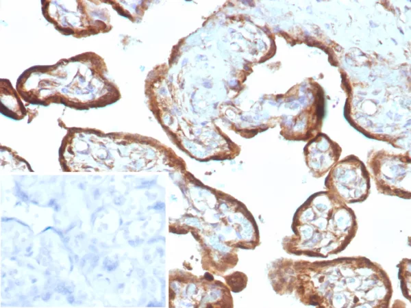 Recombinant IMP-3 Antibody