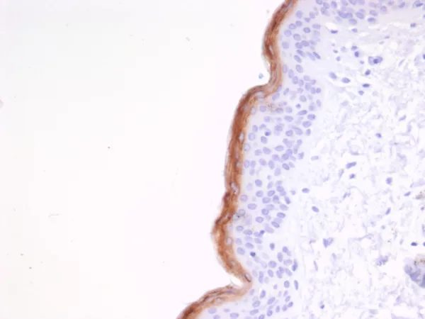 Formalin-fixed, paraffin-embedded human skin stained with Kallikrein 7 Mouse Monoclonal Antibody (KLK7/4691). HIER: Tris/EDTA, pH9.0, 45min. 2°C: HRP-polymer, 30min. DAB, 5min.