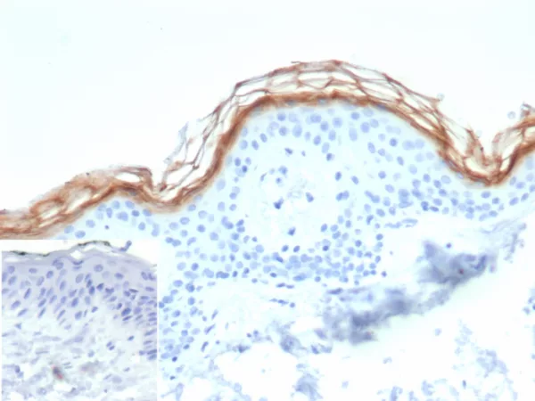 Formalin-fixed, paraffin-embedded human skin stained with Kallikrein 7 Mouse Monoclonal Antibody (KLK7/4693). Inset: PBS instead of primary antibody; secondary only negative control.
