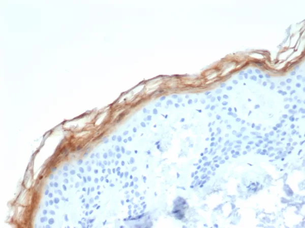 Formalin-fixed, paraffin-embedded human skin stained with Kallikrein 7 Mouse Monoclonal Antibody (KLK7/4693). HIER: Tris/EDTA, pH9.0, 45min. 2°C: HRP-polymer, 30min. DAB, 5min.