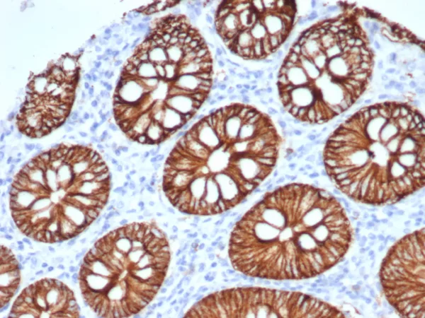 Formalin-fixed, paraffin-embedded human normal colon stained with S100A14 Mouse Monoclonal Antibody (S100A14/7401). HIER: Tris/EDTA, pH9.0, 45min. 2°C: HRP-polymer, 30min. DAB, 5min.