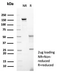 SDS-PAGE Analysis of Purified S100A14 Mouse Monoclonal Antibody (S100A14/7402). Confirmation of Purity and Integrity of Antibody.