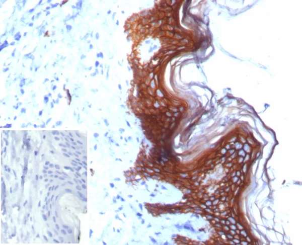 Formalin-fixed, paraffin-embedded human skin stained with S100A14 Mouse Monoclonal Antibody (S100A14/7403). Inset: PBS instead of primary antibody; secondary only negative control.