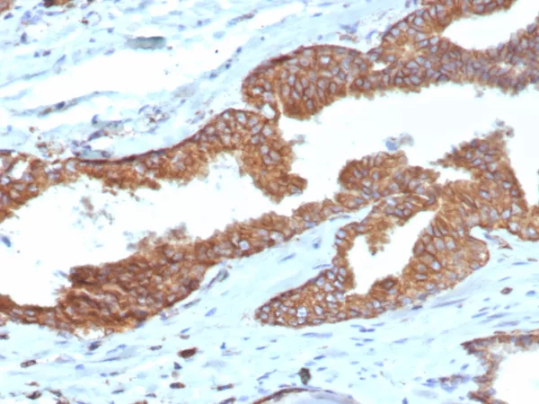 Formalin-fixed, paraffin-embedded human prostate stained with COX-2 Recombinant Rabbit Monoclonal Antibody (COX2/7803R). HIER: Tris/EDTA, pH9.0, 45min. 2: HRP-polymer, 30min. DAB, 5min.