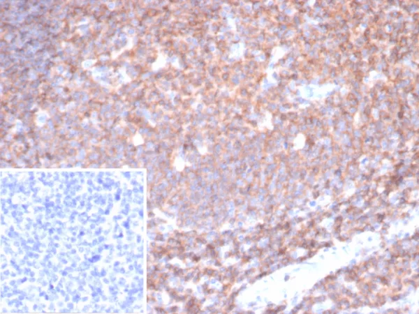 CD45 / LCA (B-Cell Marker) Antibody