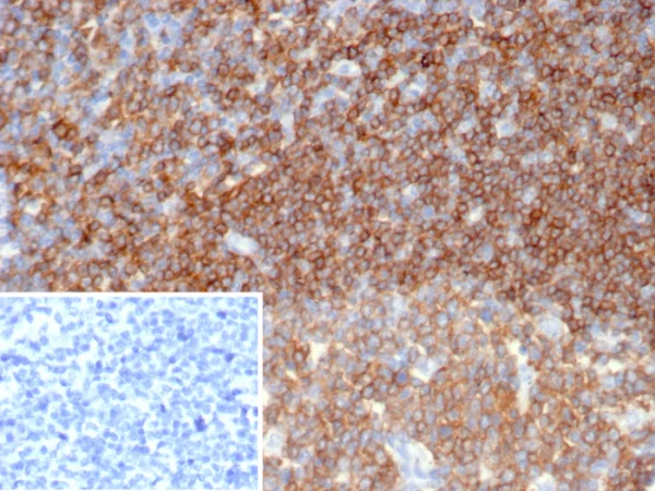 CD45 / LCA (B-Cell Marker) Antibody