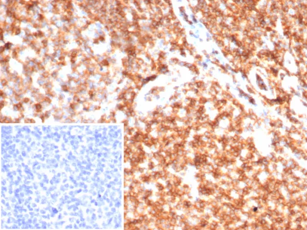 Formalin-fixed, paraffin-embedded human tonsil stained with CD45 Recombinant Mouse Monoclonal Antibody (rPTPRC/7275). Inset: PBS instead of primary antibody; secondary only negative control.