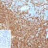 Recombinant CD45RA / LCA (B-Cell Marker) Antibody