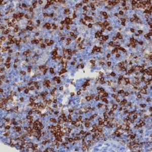 Formalin-fixed, paraffin-embedded human tonsil stained with CD45RA Recombinant Rabbit Monoclonal Antibody (PTPRC/8124R). HIER: Tris/EDTA, pH9.0, 45min. 2: HRP-polymer, 30min. DAB, 5min.