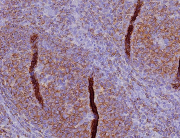 Formalin-fixed, paraffin-embedded human tonsil stained with CD45RA Recombinant Rabbit Monoclonal Antibody (PTPRC/8341R). HIER: Tris/EDTA, pH9.0, 45min. 2: HRP-polymer, 30min. DAB, 5min.