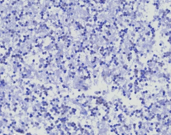 IHC analysis of formalin-fixed, paraffin-embedded human brain. Negative tissue control using PTPRC/8341R at 2ug/ml in PBS for 30min RT.  HIER: Tris/EDTA, pH9.0, 45min. 2: HRP-polymer, 30min. DAB, 5min.