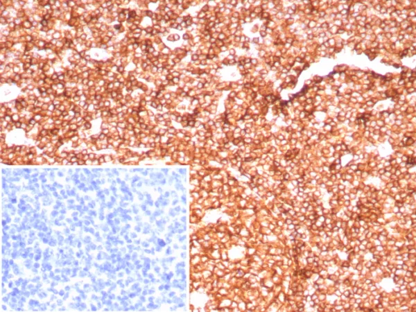 Formalin-fixed, paraffin-embedded human tonsil stained with CD45RA Recombinant Rabbit Monoclonal Antibody (PTPRC/8699R). Inset: PBS instead of primary antibody; secondary only negative control.