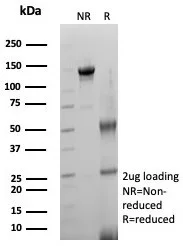 SDS-PAGE Analysis  Purified ACE2 / CD143 Rabbit Monoclonal Antibody (ACE2/8748R). Confirmation of Integrity and Purity of Antibody.