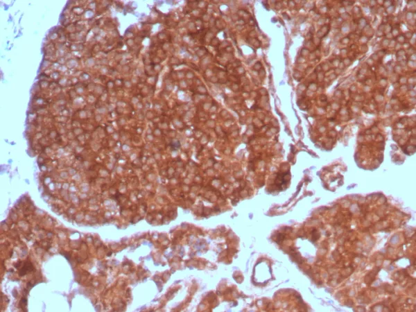 Formalin-fixed, paraffin-embedded human parathyroid gland stained with RET Proto-oncogene Mouse Monoclonal Antibody (RET/7690). HIER: Tris/EDTA, pH9.0, 45min. 2°C: HRP-polymer, 30min. DAB, 5min.