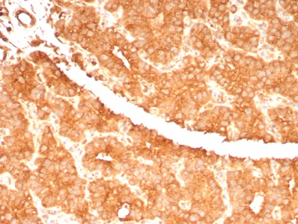 Formalin-fixed, paraffin-embedded human parathyroid gland stained with RET Proto-oncogene Mouse Monoclonal Antibody (RET/7694). HIER: Tris/EDTA, pH9.0, 45min. 2°C: HRP-polymer, 30min. DAB, 5min.