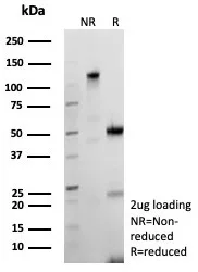SDS-PAGE Analysis of Purified Bcl-x Recombinant Rabbit Monoclonal Antibody (BCL2L1/9221R). Confirmation of Purity and Integrity of Antibody.