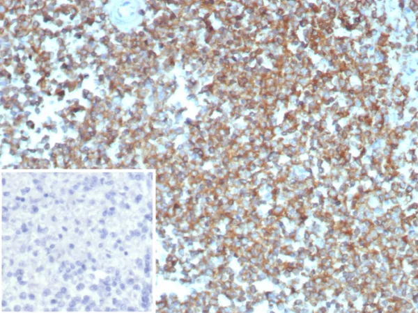 Formalin-fixed, paraffin-embedded human spleen stained with Beta Actin Mouse Monoclonal (ACTB/2370). Inset: PBS instead of primary antibody; secondary only negative control.