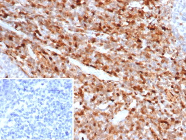 Formalin-fixed, paraffin-embedded human tonsil stained with S100A4 Mouse Monoclonal Antibody (S100A4/6799). Inset: PBS instead of primary antibody; secondary only negative control.