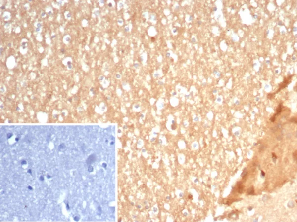 Formalin-fixed, paraffin-embedded human brain stained with S100A5 Mouse Monoclonal Antibody (S100A5/7472). Inset: PBS instead of primary antibody; secondary only negative control.