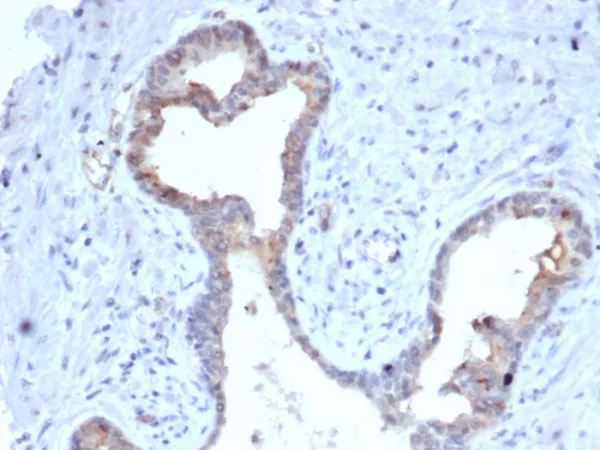 Formalin-fixed, paraffin-embedded human prostate stained with S100A5 Mouse Monoclonal Antibody (S100A5/7475).