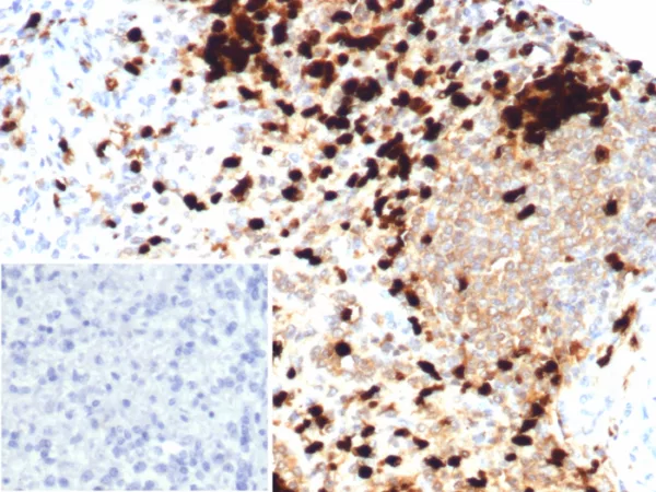 Formalin-fixed, paraffin-embedded human spleen stained with Calprotectin Mouse Monoclonal Antibody (S100A9/7550). Inset: PBS instead of primary antibody; secondary only negative control.