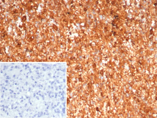 Formalin-fixed, paraffin-embedded human spleen stained with Calprotectin Mouse Monoclonal Antibody (S100A9/7551). Inset: PBS instead of primary antibody; secondary only negative control.