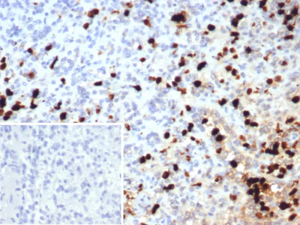 Formalin-fixed, paraffin-embedded human spleen stained with Calprotectin Mouse Monoclonal Antibody (S100A9/7552). Inset: PBS instead of primary antibody; secondary only negative control.