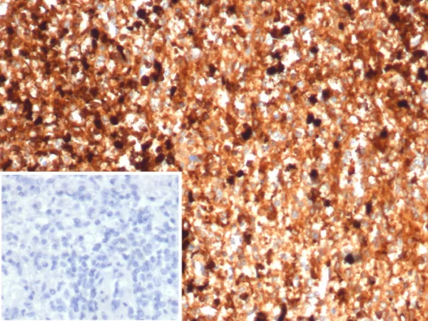 Formalin-fixed, paraffin-embedded human spleen stained with Calprotectin Mouse Monoclonal Antibody (S100A9/7553). Inset: PBS instead of primary antibody; secondary only negative control.