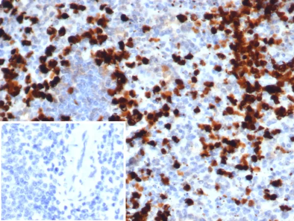 Calprotectin / MRP14 / S100A9 / Calgranulin B Antibody - Image 2