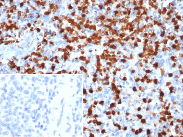 Calprotectin / MRP14 / S100A9 / Calgranulin B Antibody - Image 2