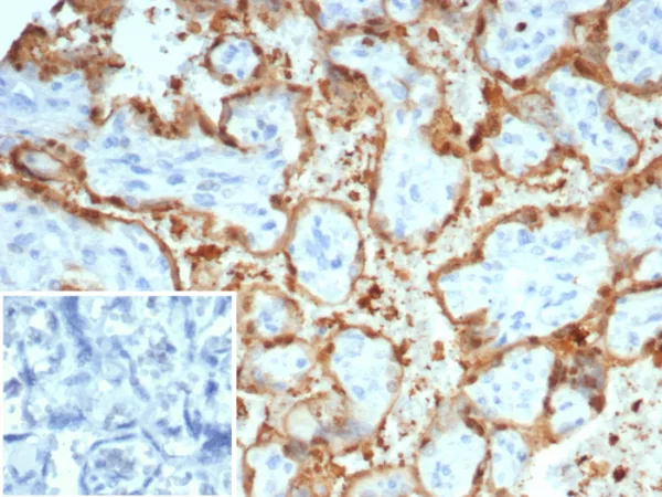 Formalin-fixed, paraffin-embedded human placenta stained with S100A12 Mouse Monoclonal Antibody (S100A12/4514). Inset: PBS instead of primary antibody; secondary only negative control.