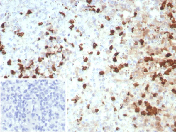 Formalin-fixed, paraffin-embedded human spleen stained with S100A12 Recombinant Rabbit Monoclonal Antibody (S100A12/8952R). Inset: PBS instead of primary antibody; secondary only negative control.