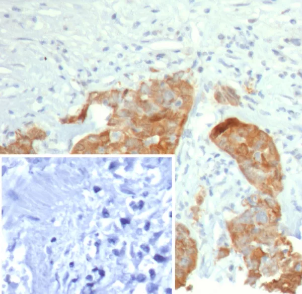 Recombinant S100P / MIG9 Antibody - Image 2