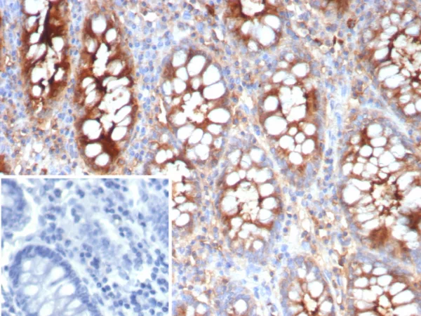 Formalin-fixed, paraffin-embedded human colon stained with  CEACAM1 Mouse Monoclonal Antibody (CEACAM1/4837). Inset: PBS instead of primary antibody; secondary only negative control.