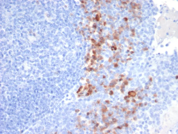 Formalin-fixed, paraffin-embedded human tonsil stained with CD138 Mouse Monoclonal Antibody (SDC1/7183). HIER: Tris/EDTA, pH9.0, 45min. 2°C: HRP-polymer, 30min. DAB, 5min.