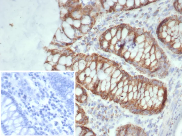 SDHA (Succinate Dehydrogenase Complex Flavoprotein Subunit A) Antibody - Image 2