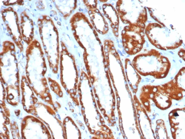 SDHA (Succinate Dehydrogenase Complex Flavoprotein Subunit A) Antibody - Image 3