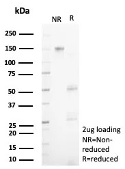 SDS-PAGE Analysis of Purified NECAB1 Mouse Monoclonal Antibody (NECAB1/7676). Confirmation of Purity and Integrity of Antibody.