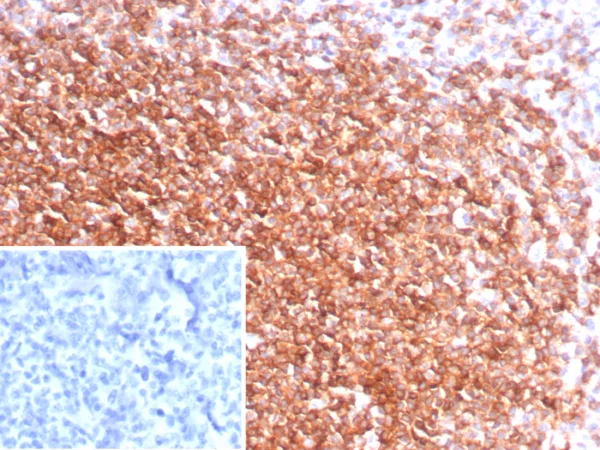 Formalin-fixed, paraffin-embedded human tonsil stained with CXCR5  Recombinant Rabbit Monoclonal Antibody (CXCR5/8146R). Inset: PBS instead of primary antibody; secondary only negative control.