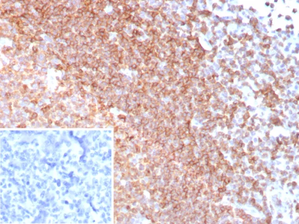 Formalin-fixed, paraffin-embedded human tonsil stained with Topo IIa Recombinant Rabbit Monoclonal Antibody (CXCR5/8279R). Inset: PBS instead of primary antibody; secondary only negative control.