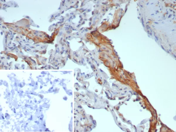 Formalin-fixed, paraffin-embedded human lung stained with Surfactant Protein D Recombinant Mouse Monoclonal (rSFTPD/8064). Inset: PBS instead of primary antibody; secondary only negative control.